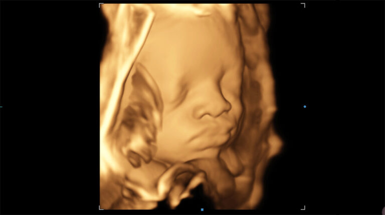 Cara fetal con 3D